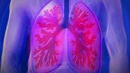 Imagem ilustrativa de um pulmão - Pixabay