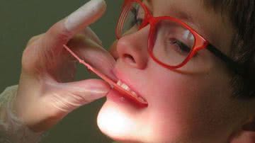 Imagem ilustrativa de uma criança no dentista - Pixabay